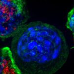 killer T cells attack cancer